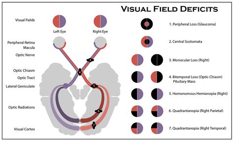 Diagnostics | Free Full-Text | A Comprehensive Performance Analysis of Transfer Learning ...