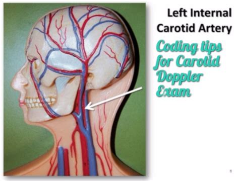 Cpt code 93880 & 93882 for Carotid Doppler coding tips