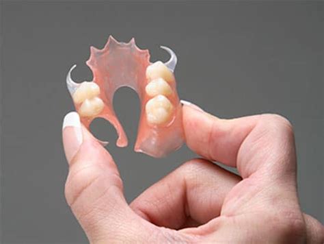 What Are Flexible Dentures? | sMiles Better