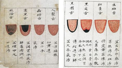 Tongue Diagnosis: Why are there teeth marks on the side of my tongue?