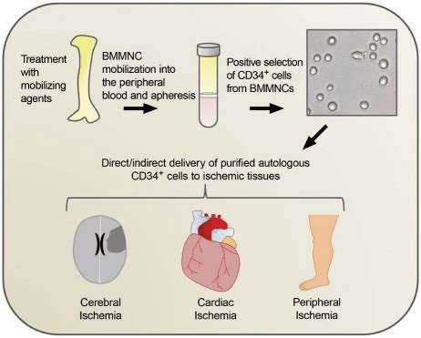 Magic of CD 34 Positive Cells | Treatment of Various Diseases | Kosheeka