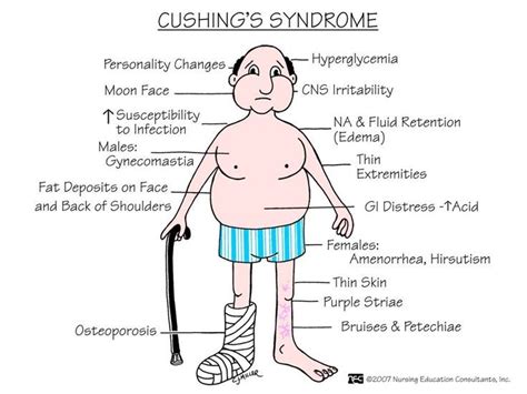 Resultado de imagen para cushing medcomic | Cushings syndrome, Nursing school prerequisites ...