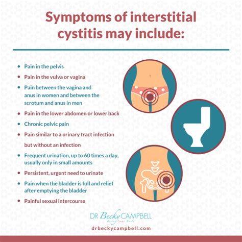 Symptoms Of Cystitis Bladder