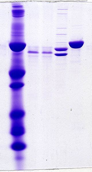 Difference Between Gel Electrophoresis and SDS PAGE - Pediaa.Com