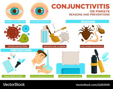 Conjunctivitis or pinkeye reasons and preventions Vector Image