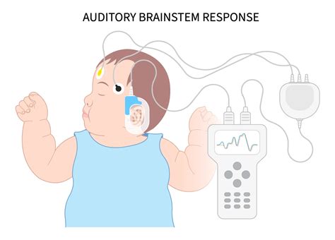 Auditory Brainstem Response (ABR) Testing | Advocate Health Care