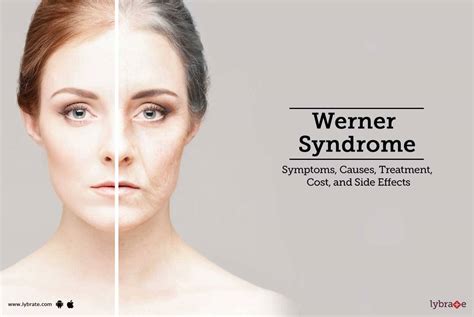 Werner Syndrome: Symptoms, Causes, Treatment, Cost, and Side Effects