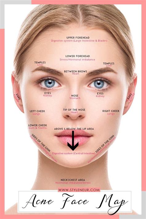 Pin by Liz Gerik on Skin Care in 2020 | Face mapping acne, Acne face chart, Acne on nose