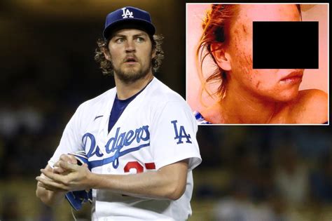 Photos, new text messages revealed in Trevor Bauer assault accusations