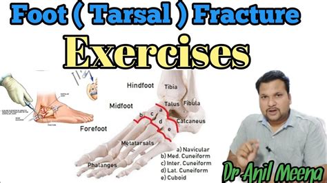 metatarsal bone fracture recovery exercises | metatarsal fracture exercises | metatarsal | in ...