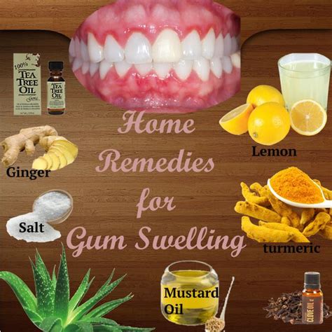 Pin on Swollen gums remedy