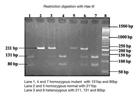 Part 2: Analysing and Interpreting (Agarose) Gel Electrophoresis Results