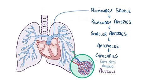 Pulmonary Embolism Diagram