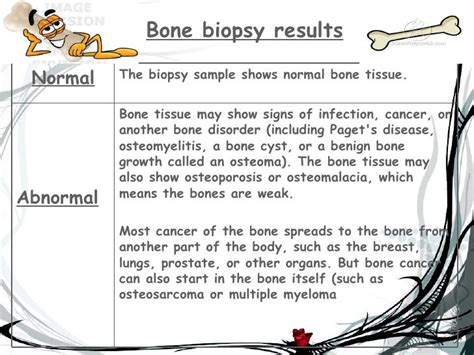 Bone Biopsy And Its Decalcification