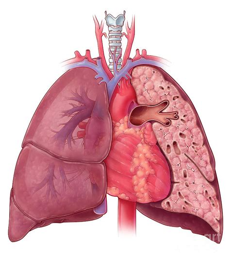 Heart And Lung Anatomy, Illustration #2 Photograph by Evan Oto - Fine ...