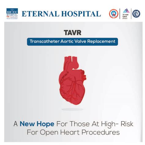 Get a New Heart with Transplant Surgery -- Eternal Hospital | PRLog