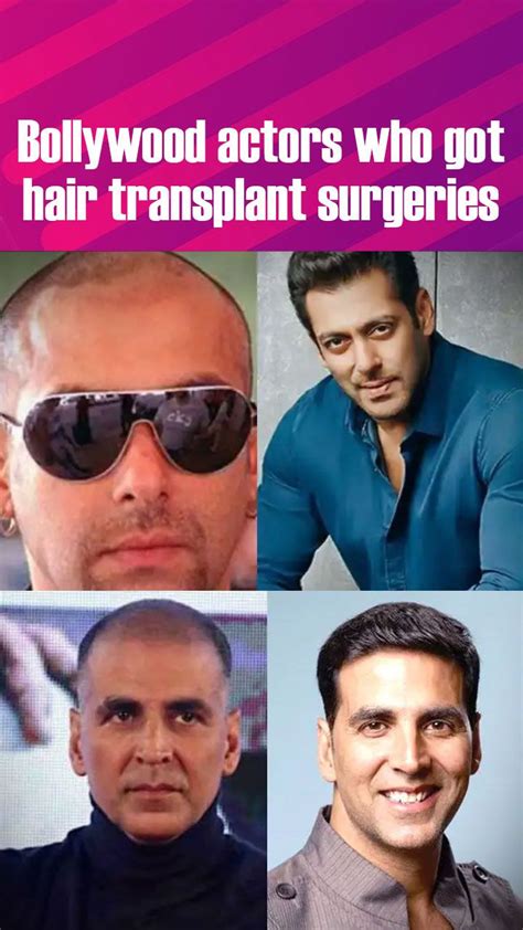 Salman Khan to Akshay Kumar: These 5 Bollywood actors underwent hair ...