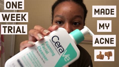 I Tried Cerave Cleanser on My Acne Prone Skin for One Week | Before and After Review - YouTube