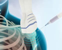 Ultrasound-Guided Shoulder Injections Reno, NV | Shoulder Pain Northern Nevada, NV