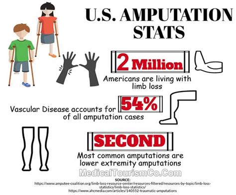 Knee Amputation Surgery Abroad