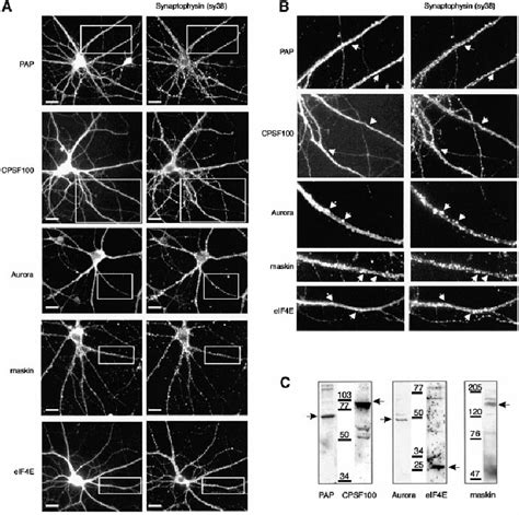 Immunolocalization of polyadenylation/translation factors in dendrites... | Download Scientific ...