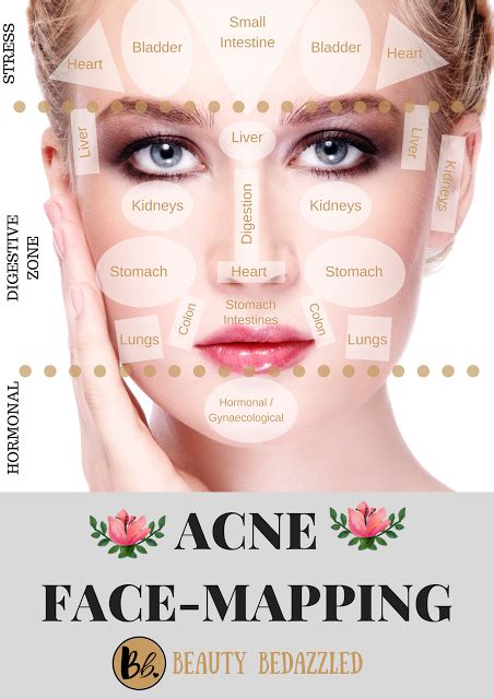 Acne Face Mapping - What does Your Acne Tell YOU? | Face mapping acne, Face acne, Face mapping