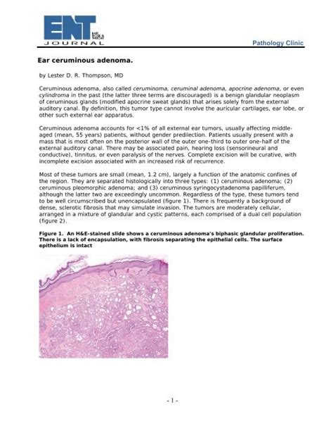 - 1 - Pathology Clinic Ear ceruminous adenoma. - Lester Thompson