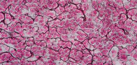 Recticular tissue-Chelsey | Fiber, Tissue, Adipose tissue