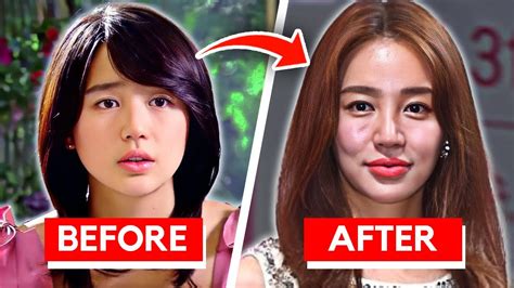 Korean Actors Who RUINED Their Face With Too Much Plastic Surgery - YouTube