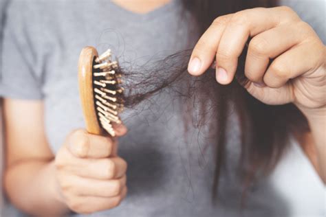 Hair Loss in Women: 15 Tips to Prevent and Manage Female Balding