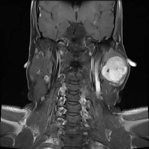 Webpathology.com: A Collection of Surgical Pathology Images