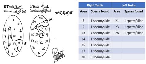 Successful Targeted Testicular Sperm Extraction Using Microsurgical Technique (microTESE ...