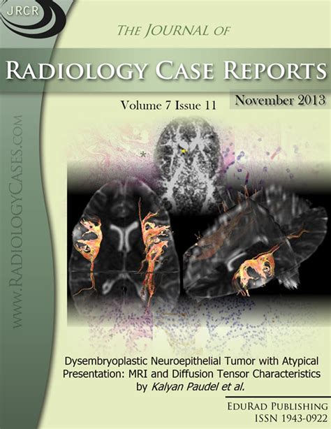 Journal of Radiology Case Reports | Free journal access | Radiology Journal