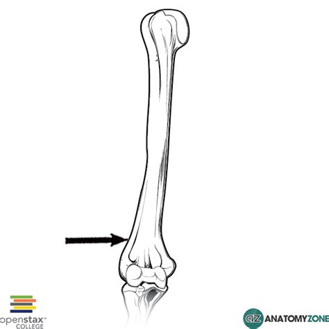 Lateral Supracondylar Ridge - AnatomyZone