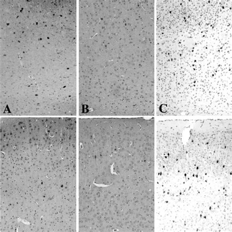 GABAergic neurons of the cerebral cortex showed normal distribution in ...