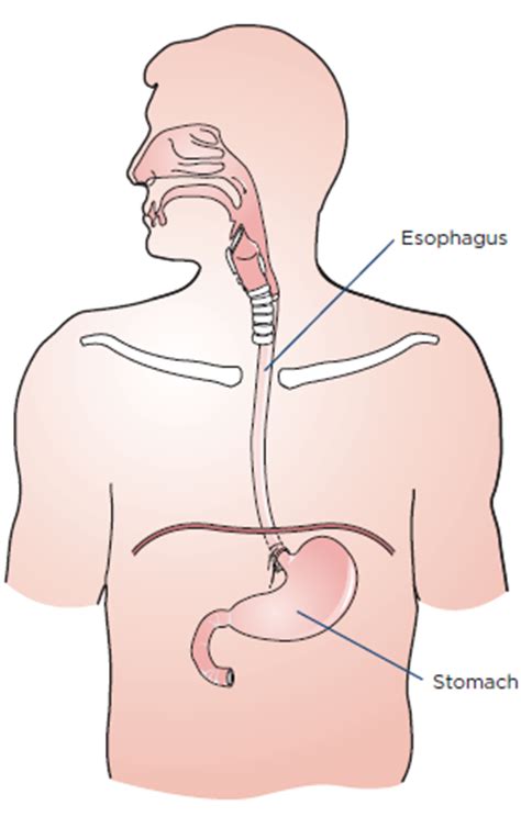 About Your Esophagectomy Surgery | Memorial Sloan Kettering Cancer Center