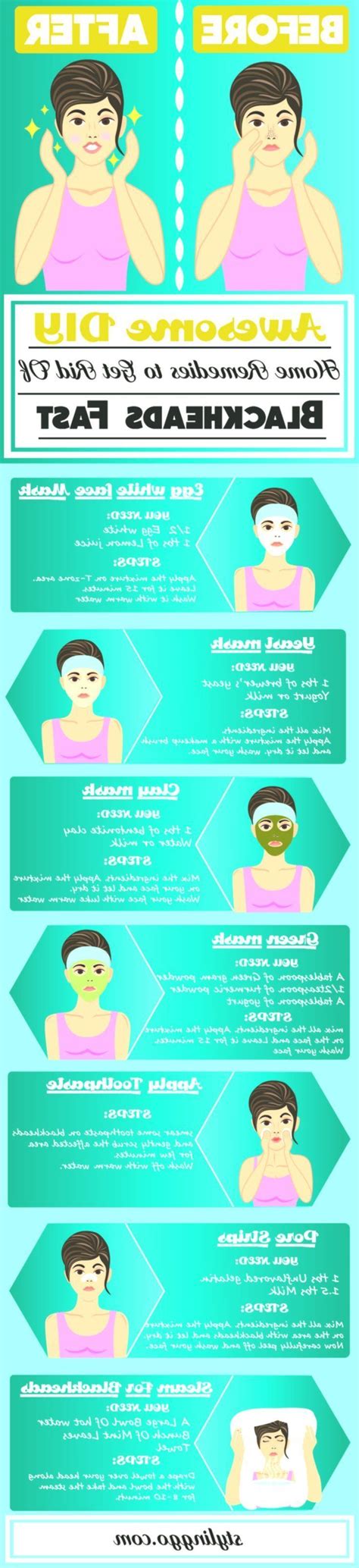 Wie man Mitesser loswird, #Blackheads #Rid Natural Sleep Remedies, Home ...