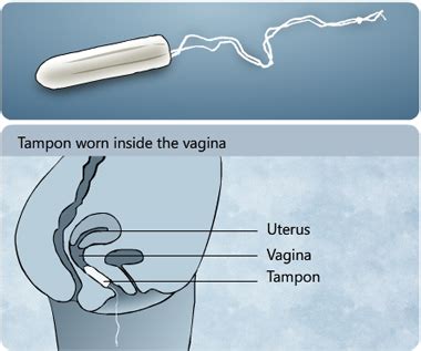 What is a tampon?