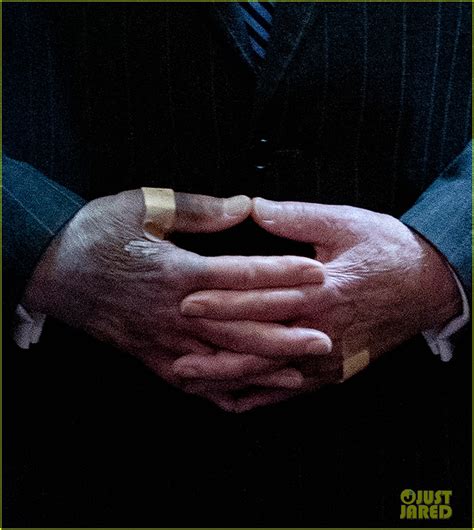 Photo: mitch mcconnell on bruised hands 01 | Photo 4494895 | Just Jared ...