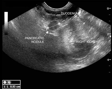 Episodes of Weakness & Hypoglycemia in a Dog | Clinician's Brief