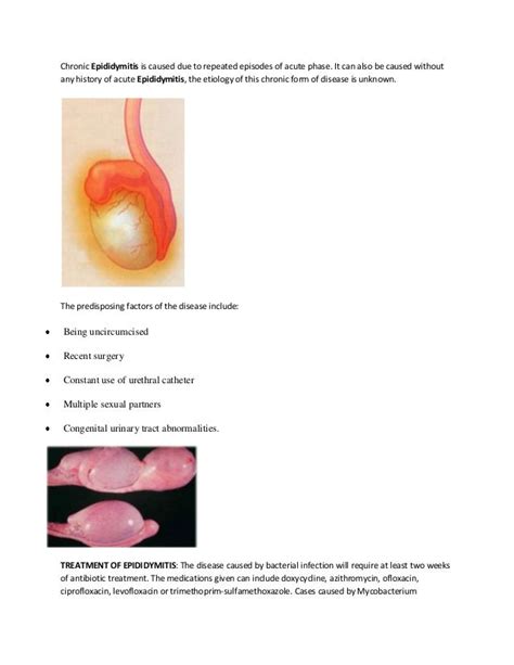 Epididymitis Treatment, Symptoms, Causes, Remedy