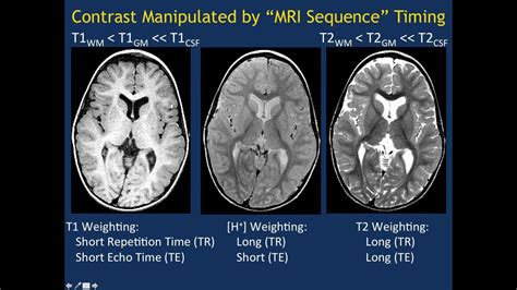 MRI Basics Part 1 - YouTube