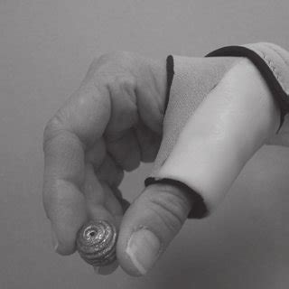 The neoprene thumb opposition splint positions the thumb more opposite... | Download Scientific ...