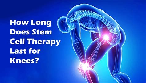 how long does stem cell therapy last for knees