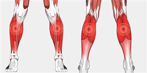 [DIAGRAM] Orthopedic Pain Diagram - MYDIAGRAM.ONLINE