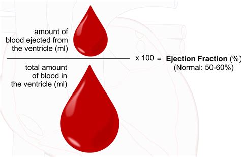 Survival Time if You Have a 20 Percent Ejection Fraction » Scary Symptoms