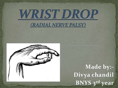 Wrist drop