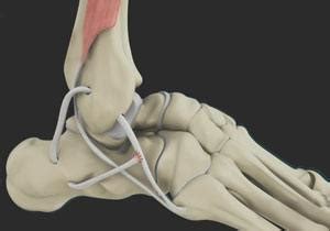 Cartilage Injury Treatment Cincinnati | Cartilage Restoration Dayton, OH