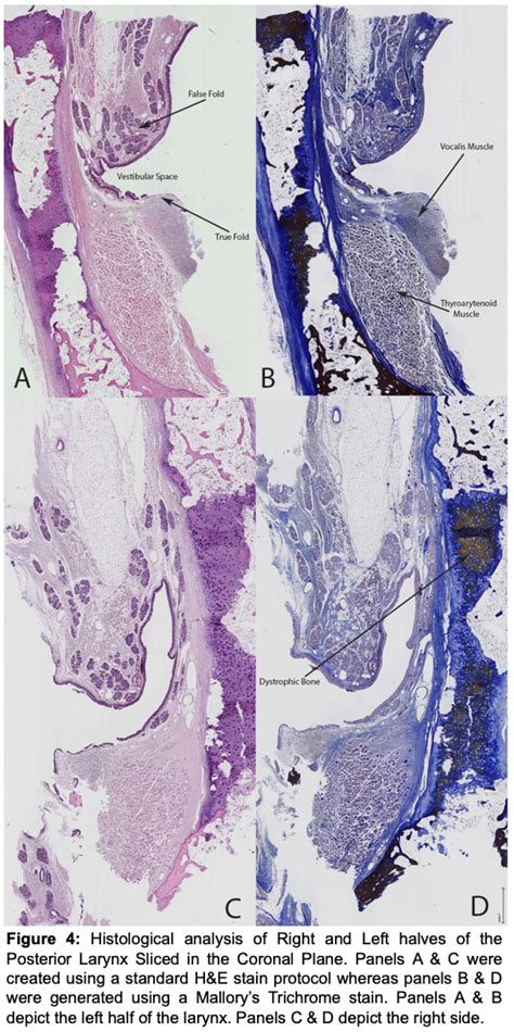 Vocalis Muscle Histology