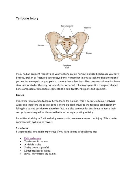 Tailbone injury